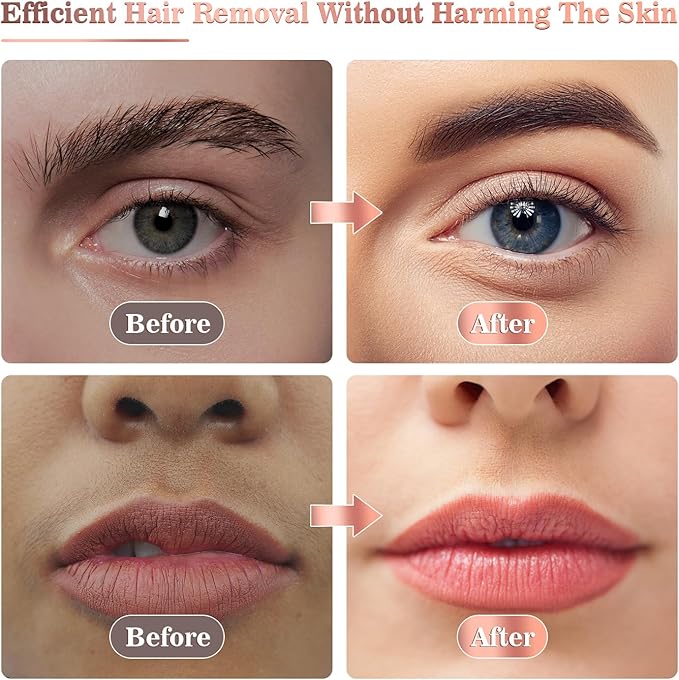 Flawless Facial Hair Remover
